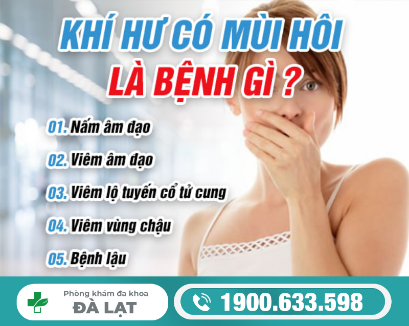 Hình ảnh minh họa